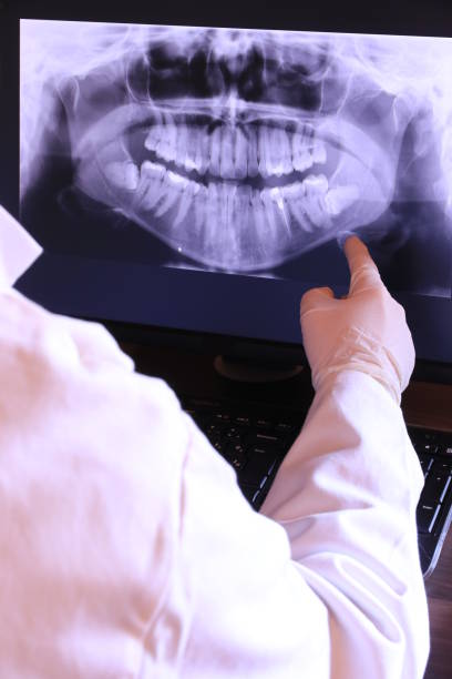 Best Broken or Cracked Tooth Emergency Dentist in Lincolnwood, IL